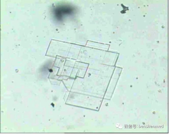 胆固醇结晶