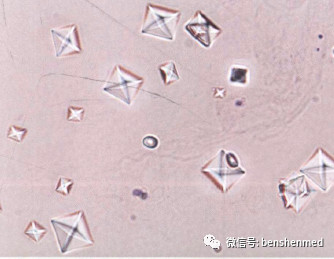 草酸钙结晶 信封样